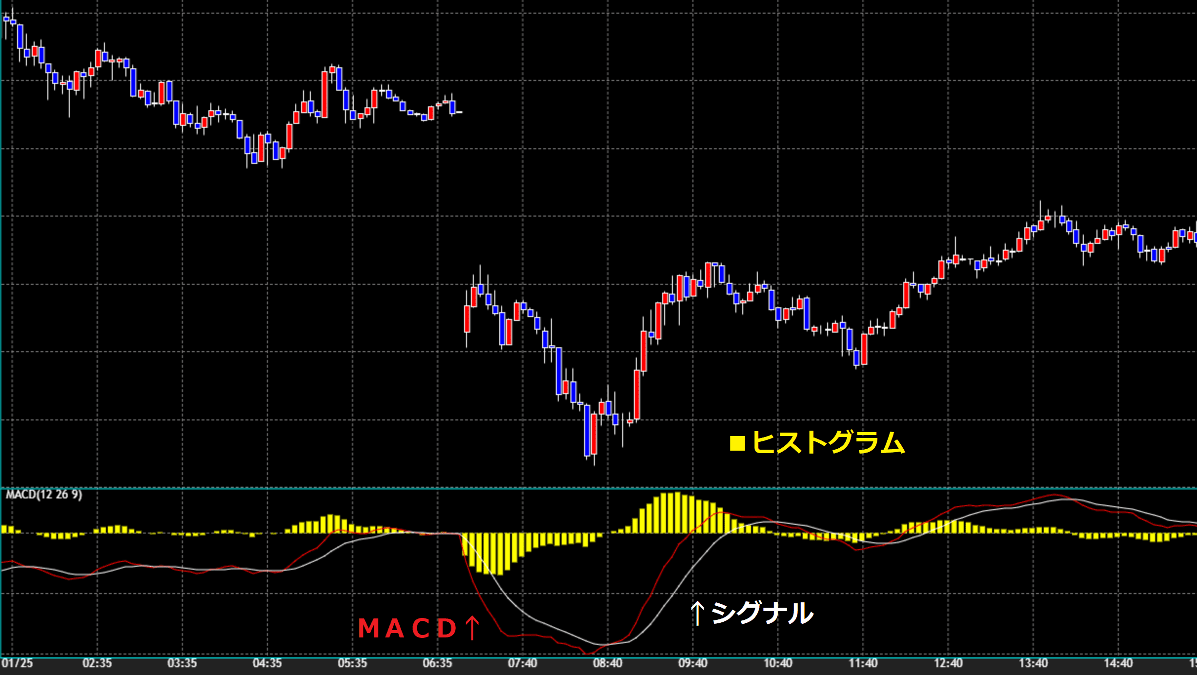 MACD